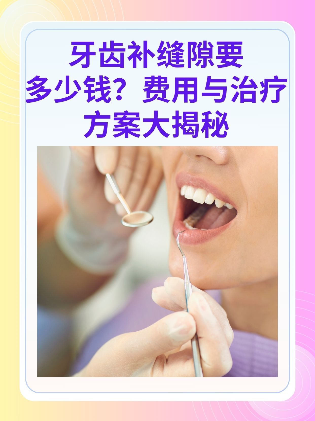 丽水补牙医保可以报销吗(补牙医保可以报销吗 哪些可以报销呢)